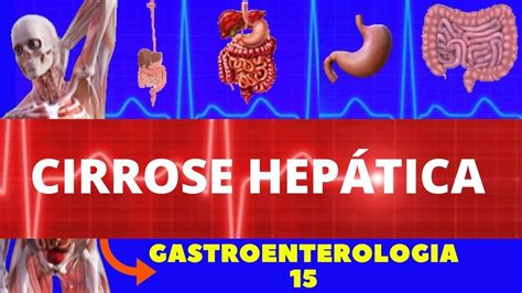 CIRROSE HEPÁTICA CAUSAS SINTOMAS DIAGNÓSTICO E TRATAMENTO