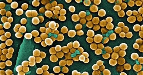 Pengertian Bakteri Staphylococcus Aureus Lengkap Dengan Bahayanya