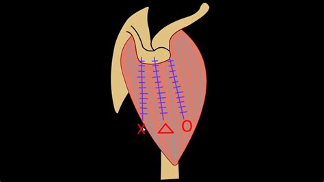 Shoulder Deltoid Split Approach Youtube