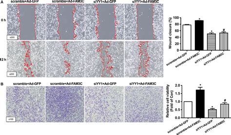 YY1 Silencing Inhibited FAM3Cpromoted Migration Of MDAMB231 Cells