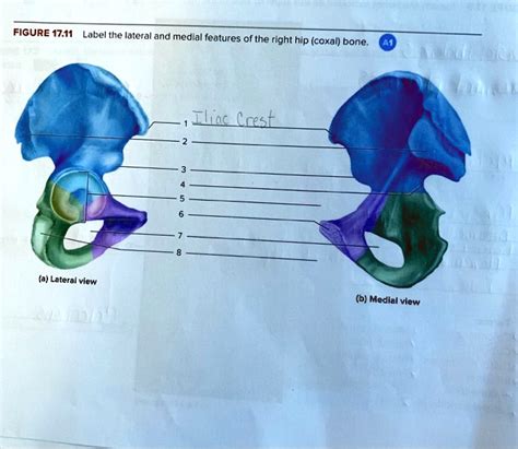 Solved Label The Lateral And Medial Features Of The Right Hip Coxal Bone Figure 17 11 Label