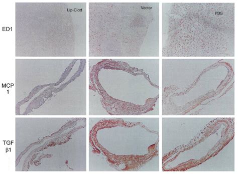 Immunohistochemistry Of Monocyte Chemotactic Protein 1 MCP 1 And