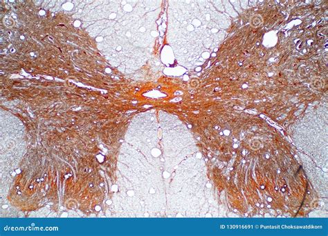 Spinal Cord Cross Section Histology Labeled