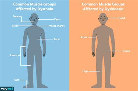 Dyskinesia Symptoms Causes Diagnosis And Treatment
