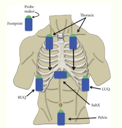 STM Exam 2 PT 1 Trauma Intro Head Shock Flashcards Quizlet