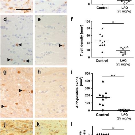 Reduced inflammation, axonal damage and gliosis after LAQ treatment.... | Download Scientific ...