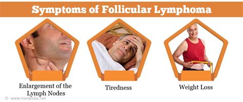 Follicular Lymphoma Symptoms