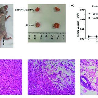 Knockdown Of Lnc Inhibited Mammary Tumors In A Nude Mouse Model