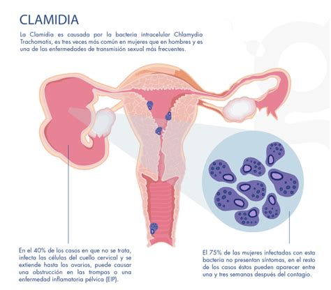 Sab S Que Es La Clamidia Te Contamos Que Afecta Y Cuidados Que Debes