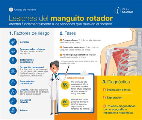 Tendinitis Del Manguito Rotador Causas S Ntomas Y Tratamiento