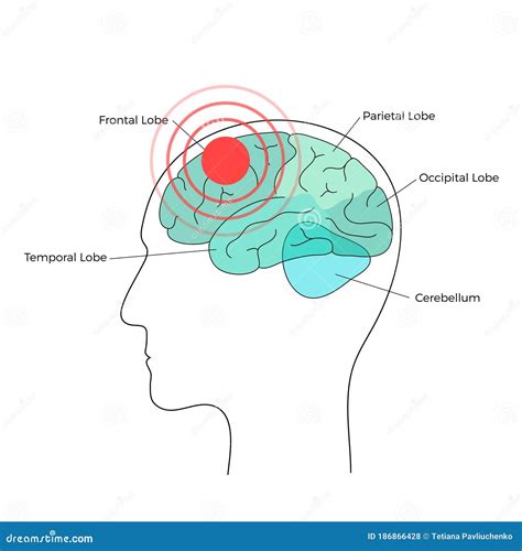 Pain Brain Illustration stock vector. Illustration of cerebral - 186866428