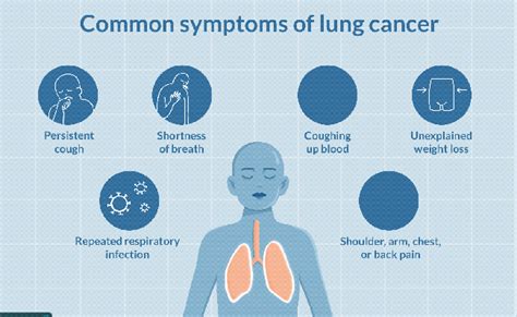 Lung Cancer Signs And Symptoms Pocket Guide Site