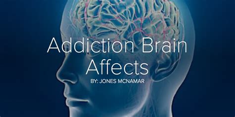 Addiction Brain Affects