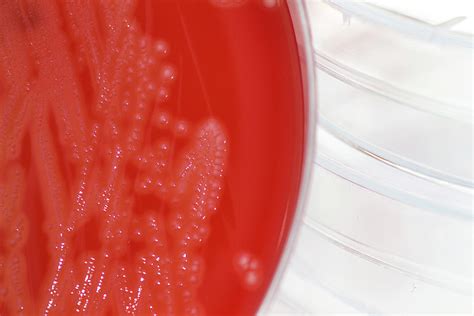 Streptococcus Agalactiae Bacteria Culture Photograph By Science Photo