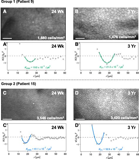 Superiority Of Mature Differentiated Cultured Human Corneal Endothelial