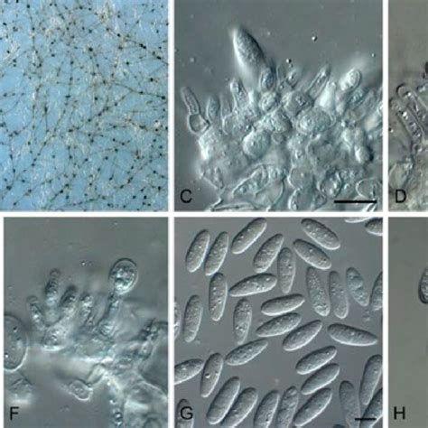 Macrophomina pseudophaseolina (CPC 21417). Pycnidia forming on pine... | Download Scientific Diagram