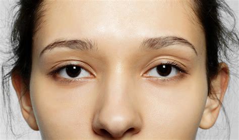 Before & After Transformations at Skin Secrets Kochi