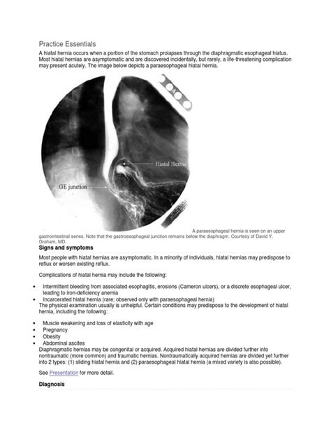 Hiatal Hernia | Esophagus | Gastroesophageal Reflux Disease