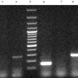 Phylogenic Typing By PCR Of The Isolates Lane 7 And 16 100 Bp DNA