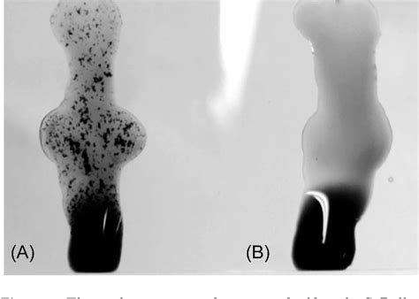 figure     salmonella pullorum agglutination antigen