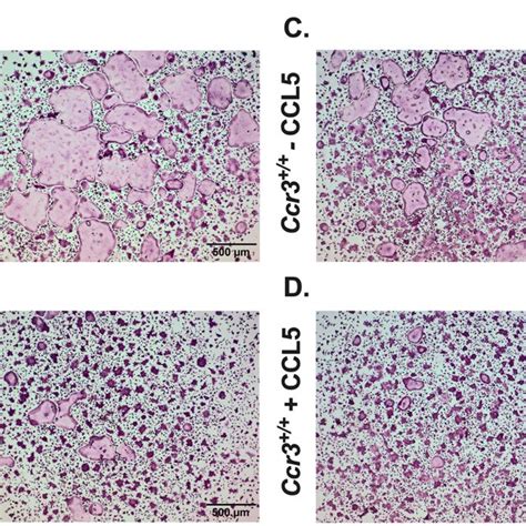 Increased Bone Formation Rate In Ccr3 Long Bones Quantification Of