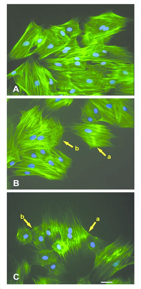 Effect Of No Treatment On Mscs F Actin Cytoskeleton Morphology A