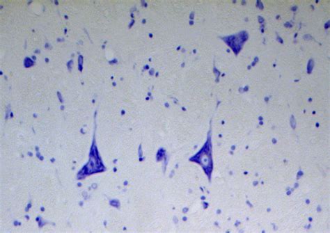nissl bodies neurons  nissl bodies  science photo library