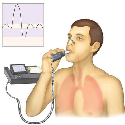 O Que É Espirometria Exame - Espirometria em Curitiba | Exame de Sopro | Incórpore