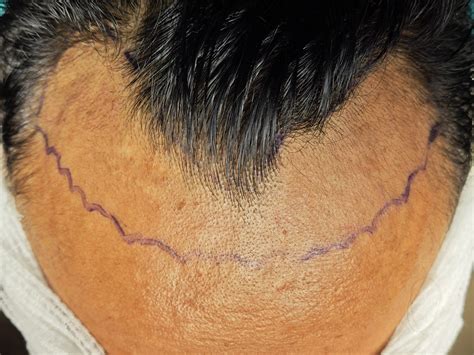 Why hair with cowlick is actually a sign of a unique growth pattern 5