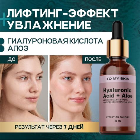 To My Skin / Сыворотка для лица увлажняющая с гиалуроновой кислотой 3D ...