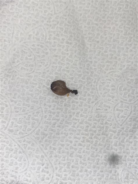 how much is a pea sized amount 4