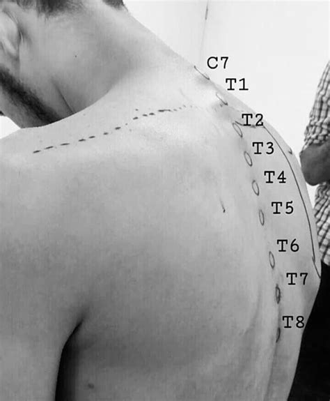 170 Physical Therapy ideas in 2025 | physical therapy, medical anatomy