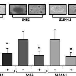 SPP1 Knockdown Impairs Wound Healing And Cell Invasion Stable ST8814