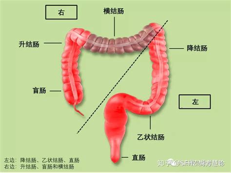 一文读懂结直肠癌的化疗靶向和免疫治疗 知乎