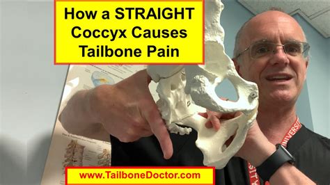 How a STRAIGHT Coccyx Causes Coccyx Pain, Tailbone Pain, Coccydynia ...