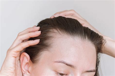 Traction Alopecia in Celina, TX | Everoak Dermatology