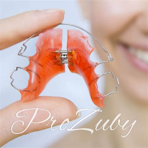 Исправление прикуса: Как лучше исправить прикус в 2023 - ProЗубы