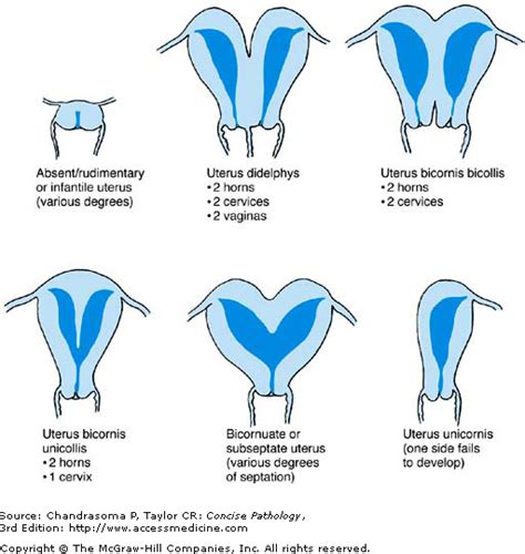 Innie Vs Outie Va Diagram Kegelbell Innie Vs Outie Vagina