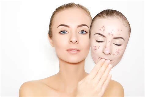 hati hati  bersihkan wajah berjerawat beauty journal