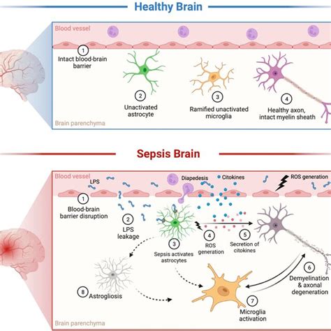 Pathophysiology Of Sepsis Induced Brain Dysfunction Sepsis Causes