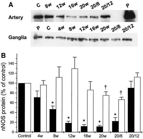 Western Blot Analysis Of NNOS Protein Reveals An Earlier Decline In The