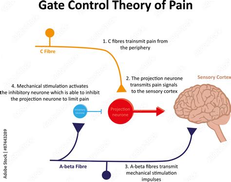 gate control theory  pain stock vector adobe stock