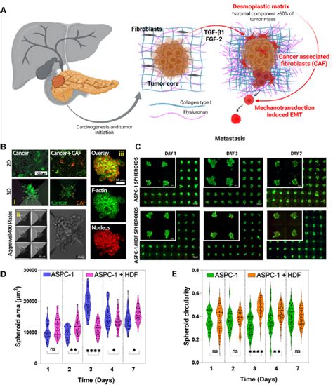 Schematic Of Pancreatic Cancer Development And Cancer Spheroid