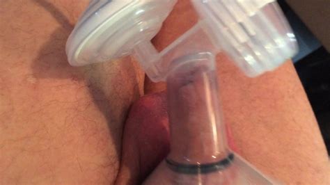 Breast Foreskin Pump Gay Cock Pumping Hd Porn Video Eb Xhamster