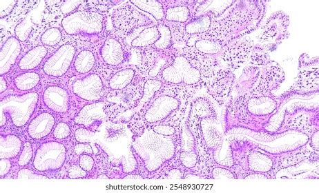 human cell tissue  microscope pathology stock photo