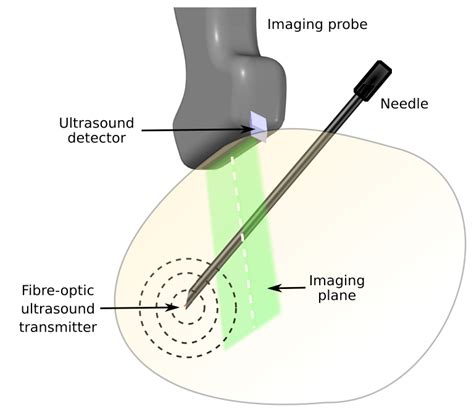 Interoperable Three Dimensional Medical Device Tracking With A Fibre