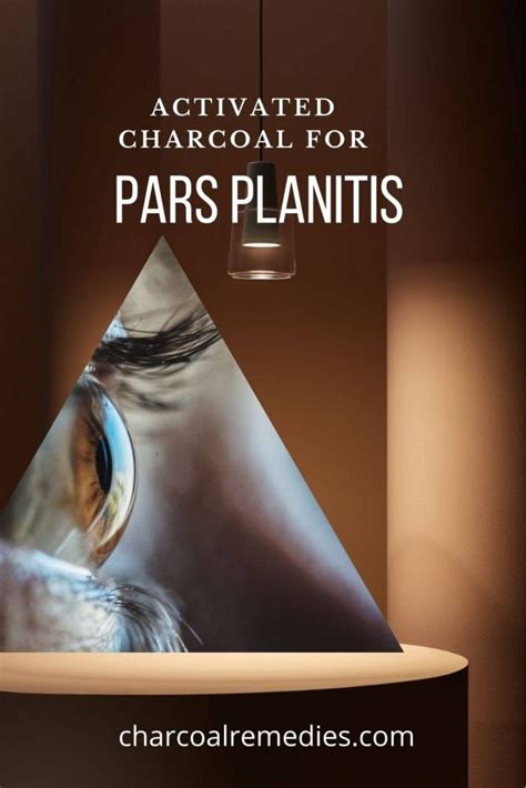 Pars Planitis – Charcoal Remedies