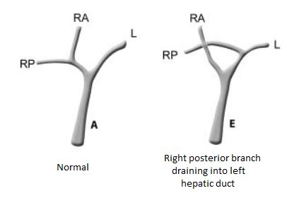 Interventional Radiology Flashcards Quizlet