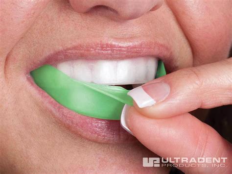 Opalescence Go Mint Prefilled Teeth Whitening Trays Guaranteed