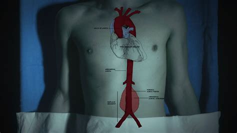 The Heart Thief Abc Iview